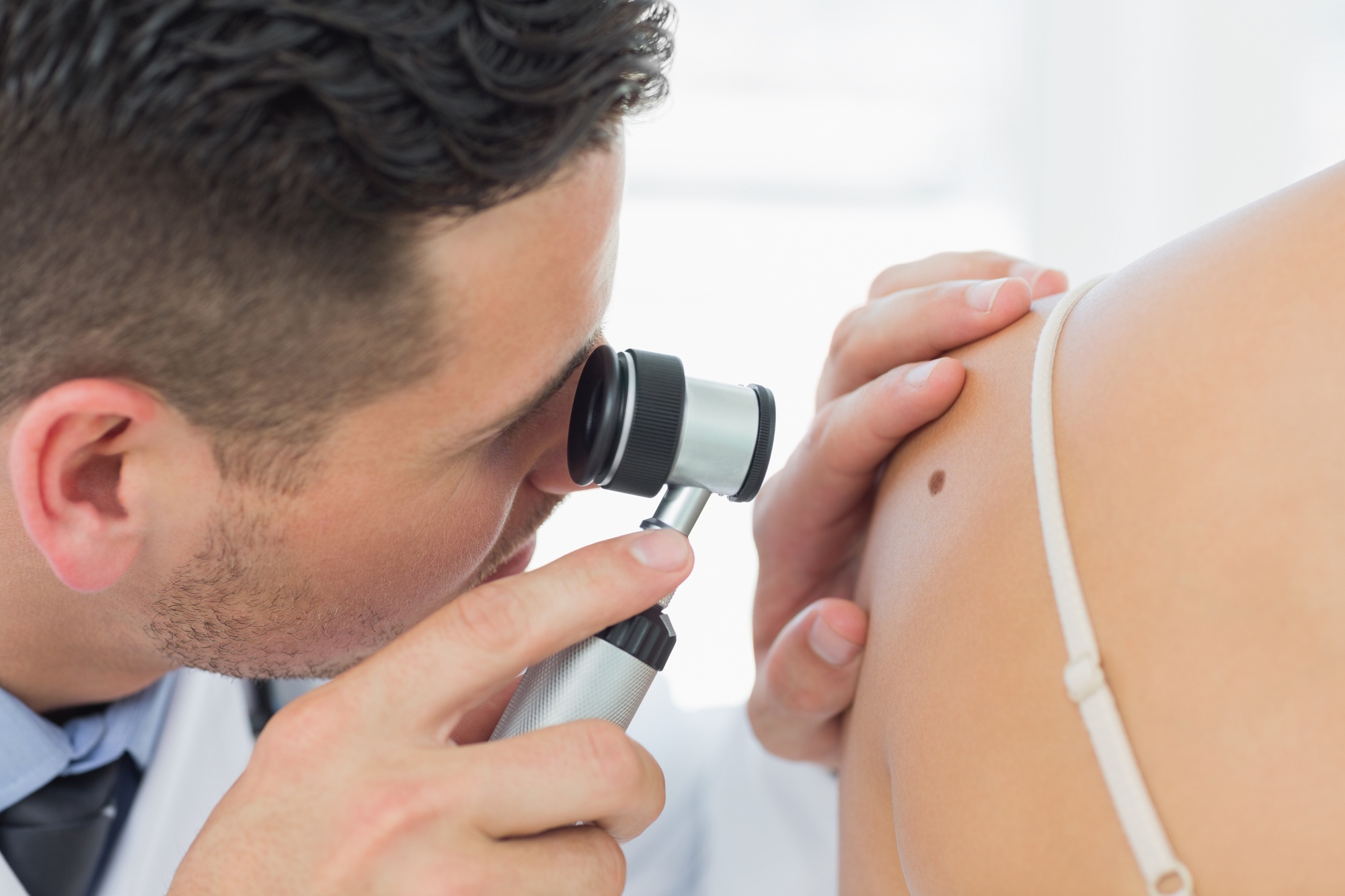 Different Types of Skin Cancer and How to Prevent Them